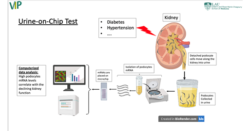 Early Diagnosis of Kidney Damage using a Urine on chip technology